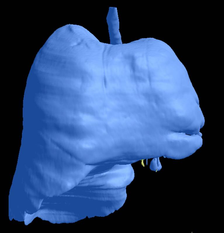 ba1