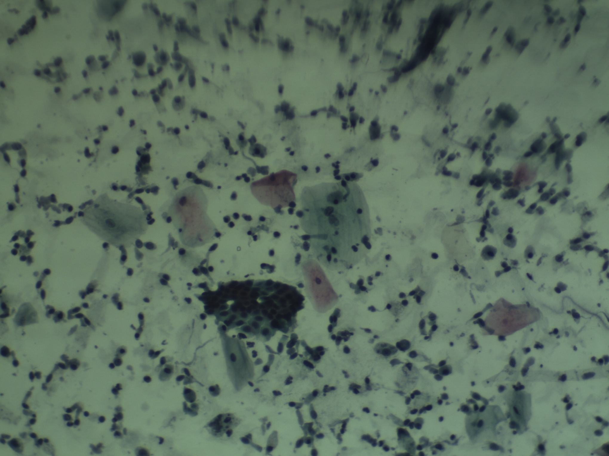 ap2
